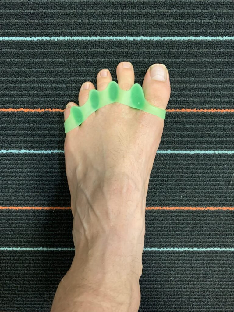 Toe spacing with Wild Toes