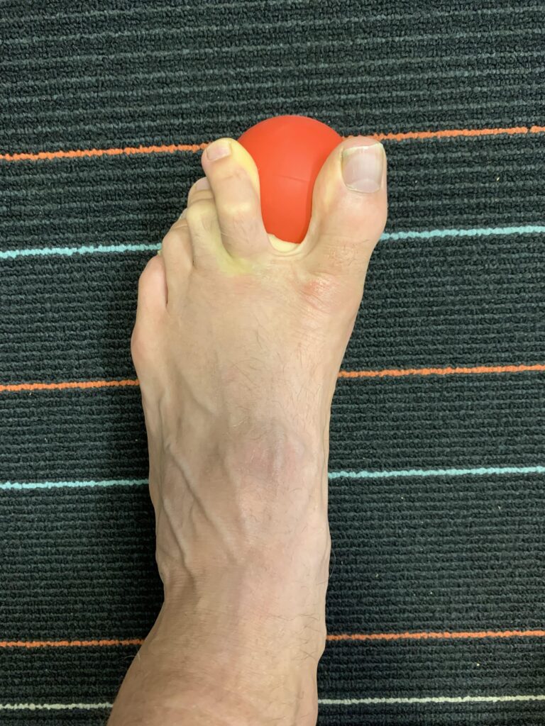 Toe spacing with trigger ball